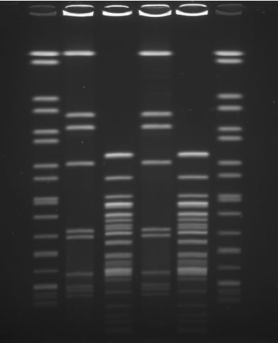 Typical PFGE result