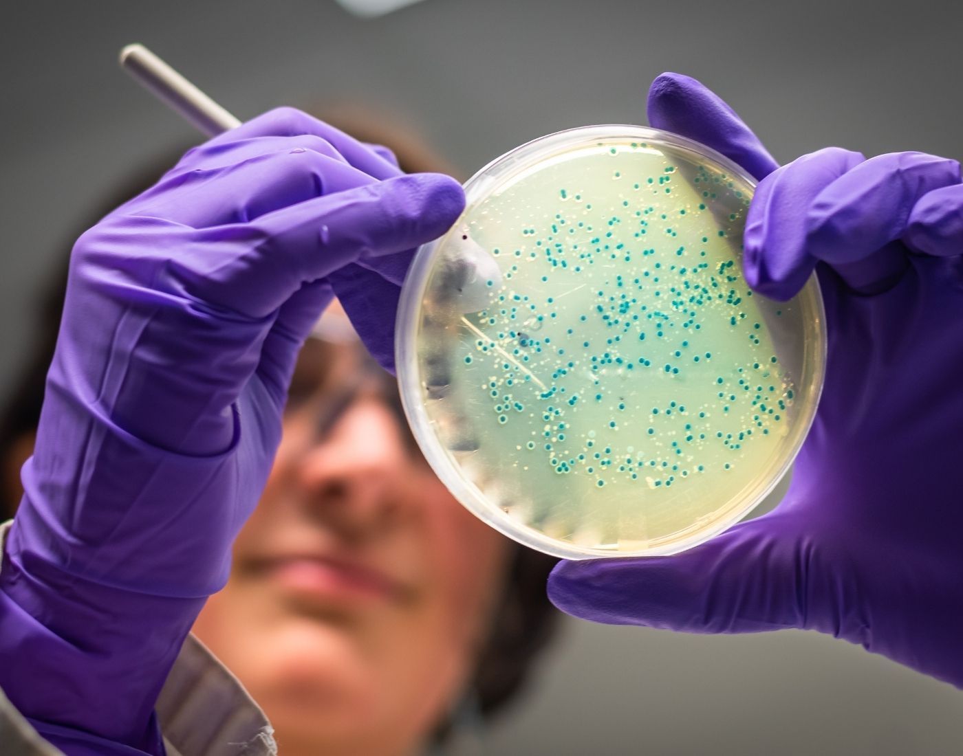 Researcher looking at a petri dish